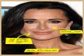 Botox, Implants & More! – Hollywood Life